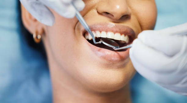 Best Emergency Dental Extractions in Perry, GA