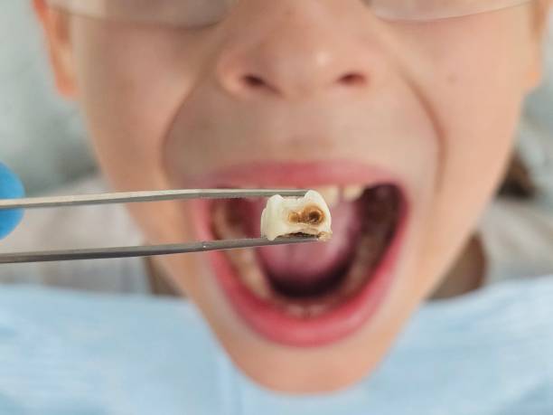 Best Pediatric Emergency Dentist in Perry, GA