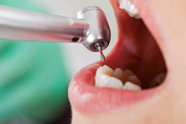 Best Weekend Emergency Dentist in Perry, GA